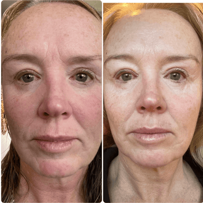 Overnight Glow Collagen Mask™️